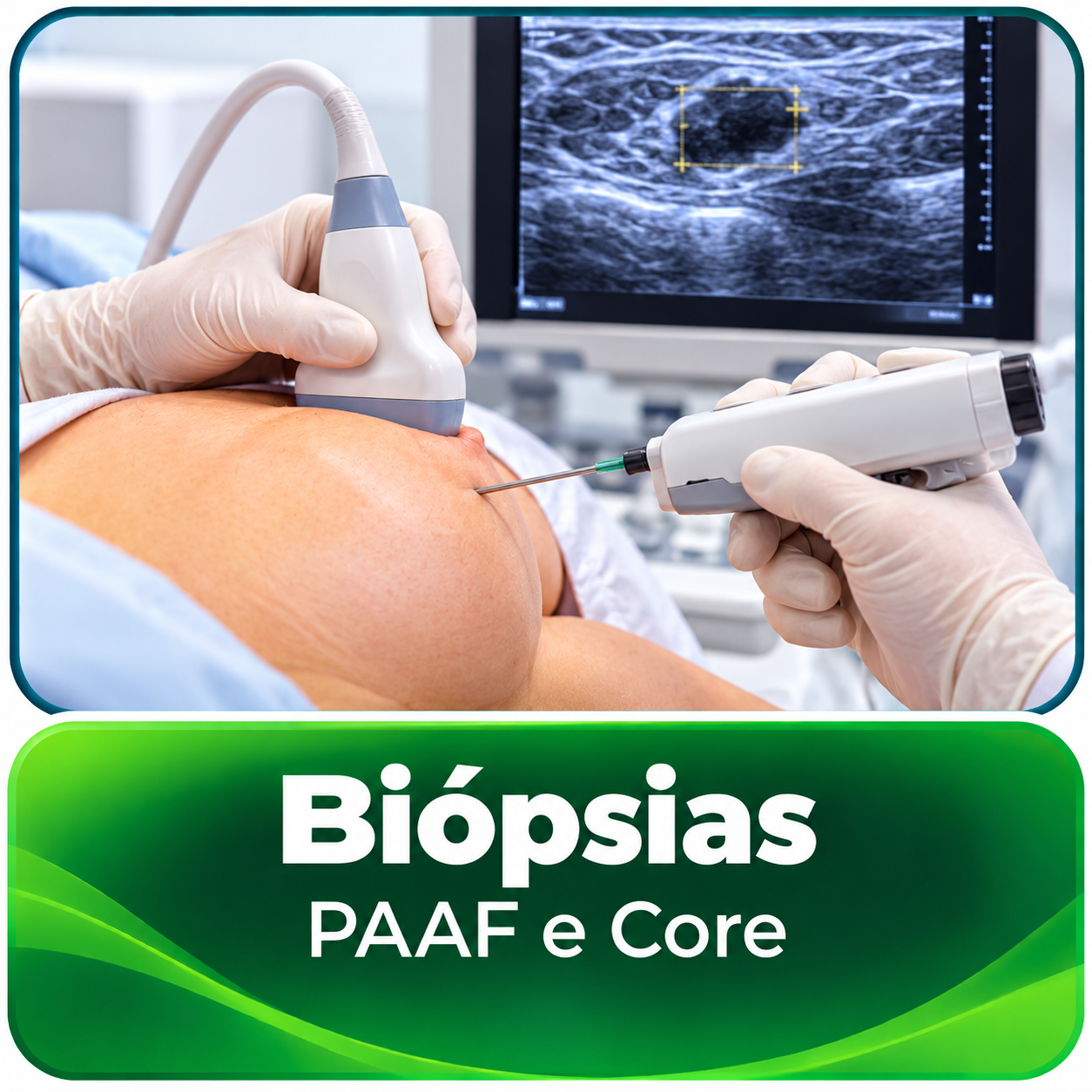 Biópsias Mamárias_ PAAF e Core