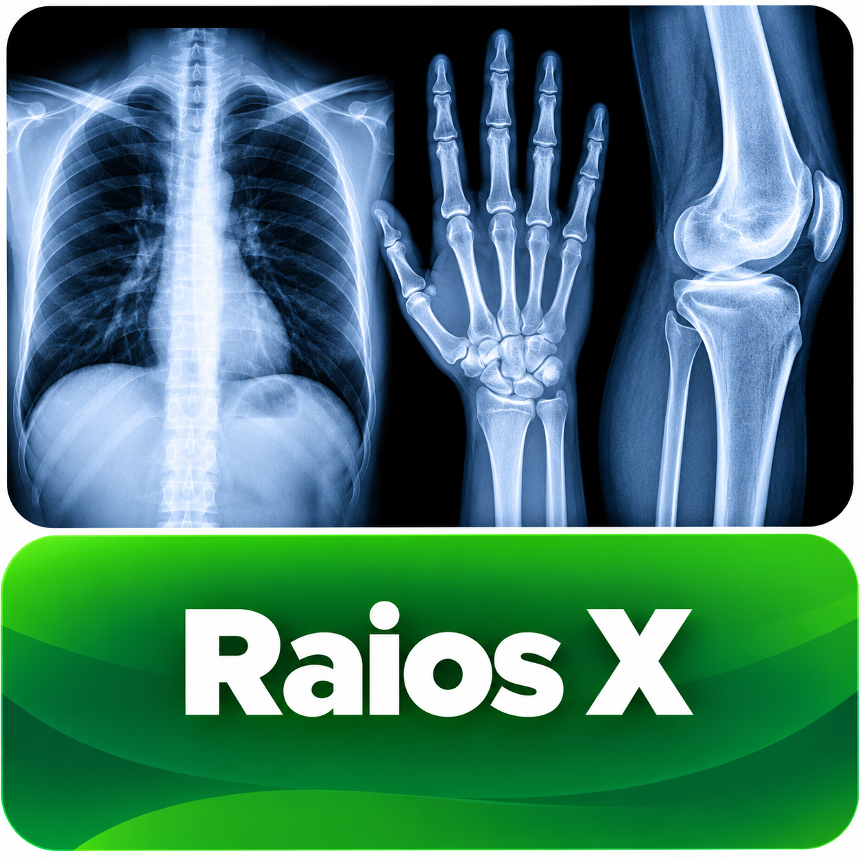 Raios X